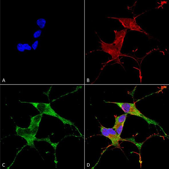 Immunocytochemistry/Immunofluorescence analysis using Mouse Anti-LRRK2/Dardarin Monoclonal Antibody, Clone N231B/34 (STMA00144). Tissue: Neuroblastoma cells (SH-SY5Y). Species: Human. Fixation: 4% PFA for 15 min. Primary Antibody: Mouse Anti-LRRK2/Dardarin Monoclonal Antibody (STMA00144) at 1:100 for overnight at 4°C with slow rocking. Secondary Antibody: AlexaFluor 488 at 1:1000 for 1 hour at RT.