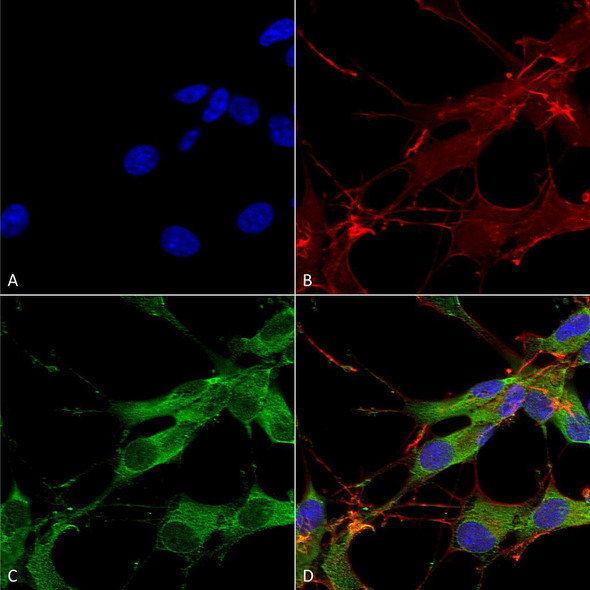 Immunocytochemistry/Immunofluorescence analysis using Mouse Anti-LRRK2/Dardarin Monoclonal Antibody, Clone N138/6 (STMA00145). Tissue: Neuroblastoma cells (SH-SY5Y). Species: Human. Fixation: 4% PFA for 15 min. Primary Antibody: Mouse Anti-LRRK2/Dardarin Monoclonal Antibody (STMA00145) at 1:100 for overnight at 4°C with slow rocking. Secondary Antibody: AlexaFluor 488 at 1:1000 for 1 hour at RT.