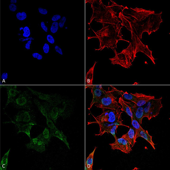 Immunocytochemistry/Immunofluorescence analysis using Mouse Anti-Protocadherin Gamma (pan) Monoclonal Antibody, Clone N159/5 (STMA00149). Tissue: Neuroblastoma cell line (SK-N-BE). Species: Human. Fixation: 4% Formaldehyde for 15 min at RT. Primary Antibody: Mouse Anti-Protocadherin Gamma (pan) Monoclonal Antibody (STMA00149) at 1:100 for 60 min at RT. Secondary Antibody: Goat Anti-Mouse ATTO 488 at 1:200 for 60 min at RT.