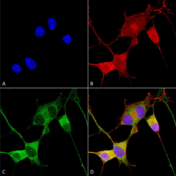 Immunocytochemistry/Immunofluorescence analysis using Mouse Anti-Ataxin 1 Monoclonal Antibody, Clone N76/8 (STMA00150). Tissue: Neuroblastoma cells (SH-SY5Y). Species: Human. Fixation: 4% PFA for 15 min. Primary Antibody: Mouse Anti-Ataxin 1 Monoclonal Antibody (STMA00150) at 1:100 for overnight at 4°C with slow rocking. Secondary Antibody: AlexaFluor 488 at 1:1000 for 1 hour at RT.