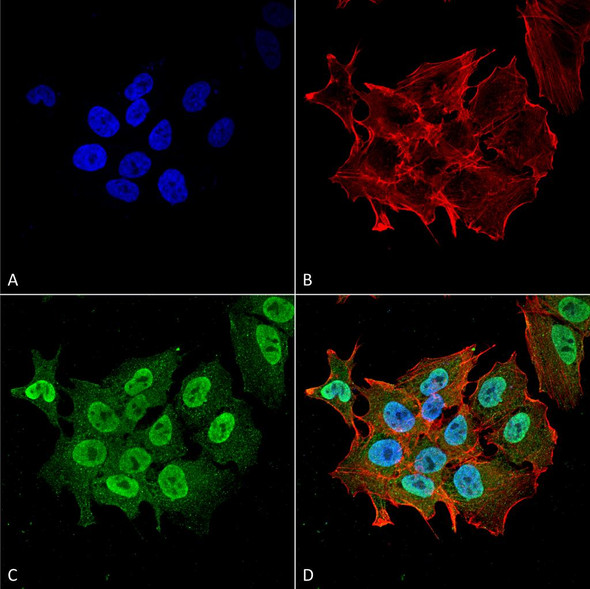 Immunocytochemistry/Immunofluorescence analysis using Mouse Anti-Ataxin 1 Monoclonal Antibody, Clone N76/8 (STMA00150). Tissue: Neuroblastoma cell line (SK-N-BE). Species: Human. Fixation: 4% Formaldehyde for 15 min at RT. Primary Antibody: Mouse Anti-Ataxin 1 Monoclonal Antibody (STMA00150) at 1:100 for 60 min at RT. Secondary Antibody: Goat Anti-Mouse ATTO 488 at 1:200 for 60 min at RT.