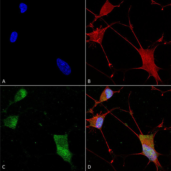 Immunocytochemistry/Immunofluorescence analysis using Mouse Anti-Neuroligin 1 Monoclonal Antibody, Clone N97A/31 (STMA00156). Tissue: Neuroblastoma cells (SH-SY5Y). Species: Human. Fixation: 4% PFA for 15 min. Primary Antibody: Mouse Anti-Neuroligin 1 Monoclonal Antibody (STMA00156) at 1:100 for overnight at 4°C with slow rocking. Secondary Antibody: AlexaFluor 488 at 1:1000 for 1 hour at RT.
