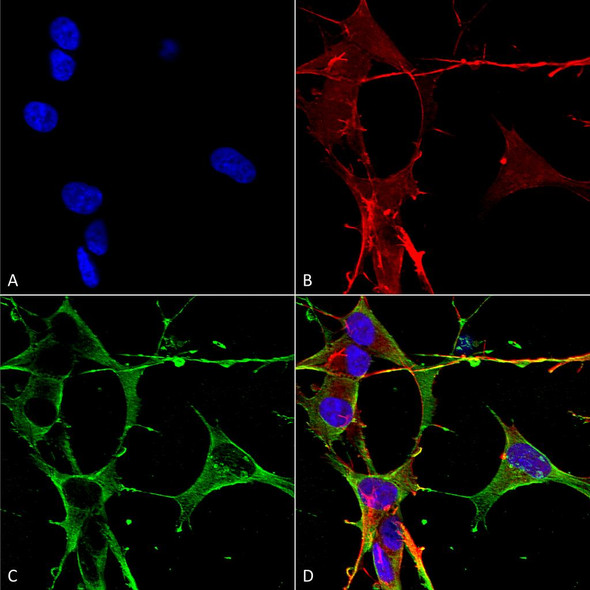 Immunocytochemistry/Immunofluorescence analysis using Mouse Anti-Neuroligin 3 Monoclonal Antibody, Clone N110/29 (STMA00159). Tissue: Neuroblastoma cells (SH-SY5Y). Species: Human. Fixation: 4% PFA for 15 min. Primary Antibody: Mouse Anti-Neuroligin 3 Monoclonal Antibody (STMA00159) at 1:50 for overnight at 4°C with slow rocking. Secondary Antibody: AlexaFluor 488 at 1:1000 for 1 hour at RT.