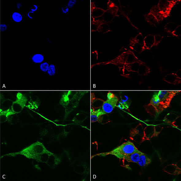 Immunocytochemistry/Immunofluorescence analysis using Mouse Anti-GABA-A Receptor Alpha 2 Monoclonal Antibody, Clone N399/19 (STMA00166). Tissue: Neuroblastoma cells (SH-SY5Y). Species: Human. Fixation: 4% PFA for 15 min. Primary Antibody: Mouse Anti-GABA-A Receptor Alpha 2 Monoclonal Antibody (STMA00166) at 1:200 for overnight at 4°C with slow rocking. Secondary Antibody: AlexaFluor 488 at 1:1000 for 1 hour at RT.