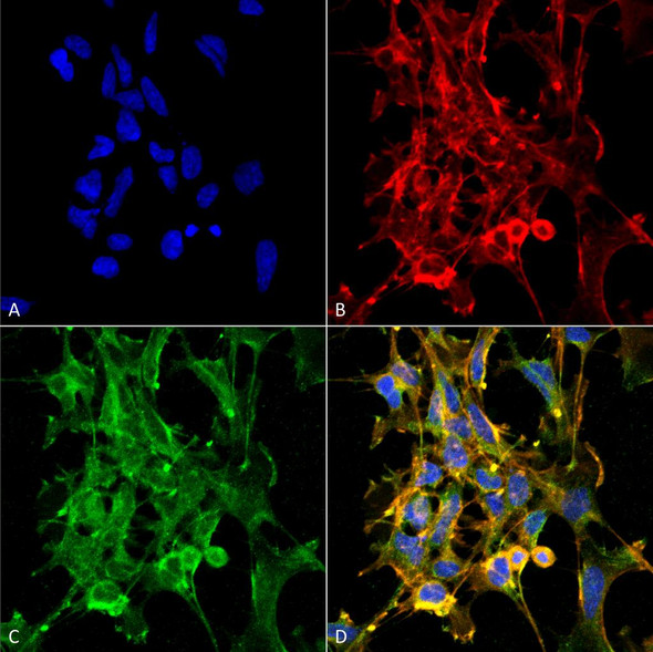 Immunocytochemistry/Immunofluorescence analysis using Mouse Anti-Citrulline Monoclonal Antibody, Clone 6C2.1 (STMA00174). Tissue: Embryonic kidney epithelial cell line (HEK293). Species: Human. Fixation: 5% Formaldehyde for 5 min. Primary Antibody: Mouse Anti-Citrulline Monoclonal Antibody (STMA00174) at 1:50 for 30-60 min at RT. Secondary Antibody: Goat Anti-Mouse Alexa Fluor 488 at 1:1500 for 30-60 min at RT.