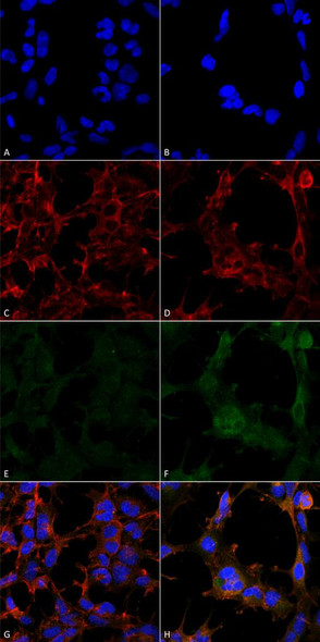 Immunocytochemistry/Immunofluorescence analysis using Mouse Anti-Hexanoyl-Lysine adduct Monoclonal Antibody, Clone 5D9 (STMA00179). Tissue: Embryonic kidney epithelial cell line (HEK293). Species: Human. Fixation: 5% Formaldehyde for 5 min. Primary Antibody: Mouse Anti-Hexanoyl-Lysine adduct Monoclonal Antibody (STMA00179) at 1:50 for 30-60 min at RT. Secondary Antibody: Goat Anti-Mouse Alexa Fluor 488 at 1:1500 for 30-60 min at RT.