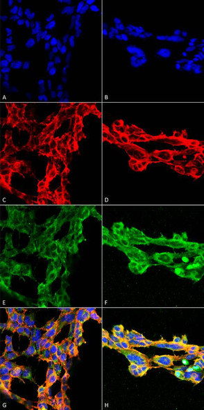 Immunocytochemistry/Immunofluorescence analysis using Mouse Anti-7-Ketocholesterol Monoclonal Antibody, Clone 7E1 (STMA00183). Tissue: Embryonic kidney epithelial cell line (HEK293). Species: Human. Fixation: 5% Formaldehyde for 5 min. Primary Antibody: Mouse Anti-7-Ketocholesterol Monoclonal Antibody (STMA00183) at 1:50 for 30-60 min at RT. Secondary Antibody: Goat Anti-Mouse Alexa Fluor 488 at 1:1500 for 30-60 min at RT.