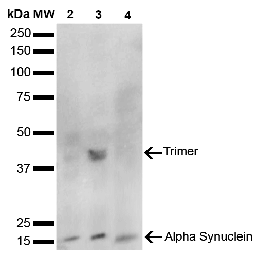 Western Blot analysis of Human, Mouse, Rat Brain showing detection of 14 kDa Alpha Synuclein protein using Mouse Anti-Alpha Synuclein Monoclonal Antibody, Clone 10H7 (STMA00192). Lane 1: Molecular Weight Ladder (MW). Lane 2: Mouse Brain cell lysate. Lane 3: Rat brain cell lysate. Lane 4: Human brain cell lysate. Load: 15 µg. Block: 5% Skim Milk in 1X TBST.