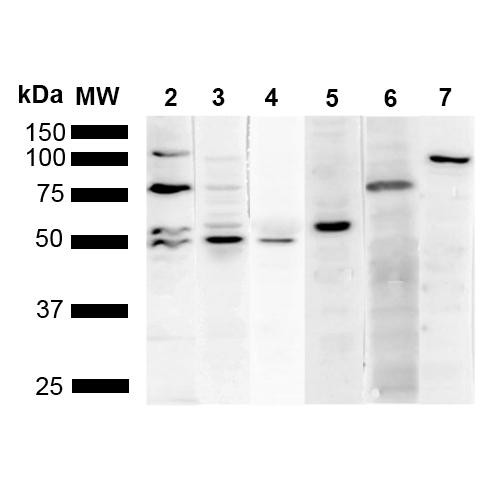 Western Blot analysis of Human Cervical cancer cell line (HeLa) lysate showing detection of Multiple KDEL protein using Mouse Anti-KDEL Monoclonal Antibody, Clone 2D6 (STMA00196). Lane 1: Molecular Weight Ladder (MW). Lane 2: Anti-KDEL (STMA00196). Lane 3: Anti-KDEL control (STPA00008). Lane 4: Anti-PDI control (STPA00010). Lane 5: Anti-Calreticulin control (STPA00017). Lane 6: Anti-GRP78 control (STPA00006). Lane 7: Anti-GRP94 control.