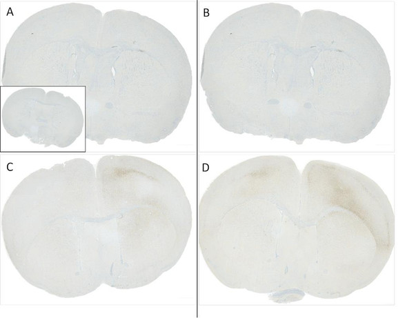 Immunohistochemistry analysis using Rabbit Anti-Alpha Synuclein pSer129 Monoclonal Antibody, Clone J18 (STMA00206). Tissue: Brain. Species: Mouse. Primary Antibody: Rabbit Anti-Alpha Synuclein pSer129 Monoclonal Antibody (STMA00206) at 1:10000. Secondary Antibody: anti-rabbit HRP. C57/BL6 mice were injected with 5 ug sonicated mouse recombinant alpha synuclein PFFs at 8 weeks of age.