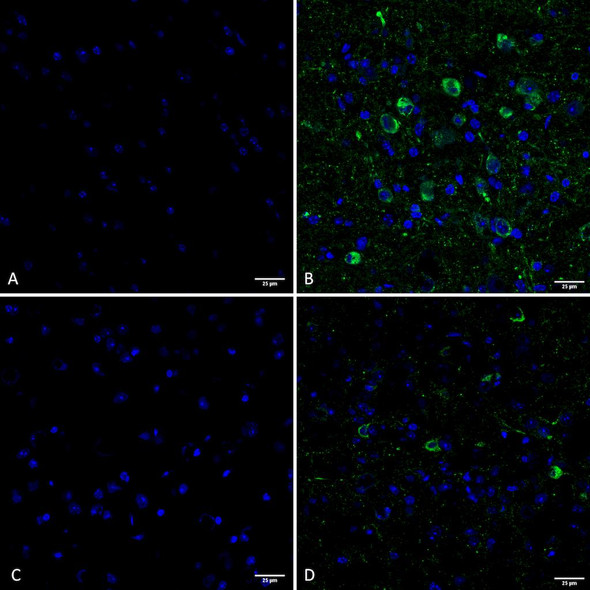 Immunohistochemistry analysis using Rabbit Anti-Tau Monoclonal Antibody, Clone AH36 (STMA00207). Tissue: Brain slice. Species: Mouse. Primary Antibody: Rabbit Anti-Tau Monoclonal Antibody (STMA00207) at 1:500 for Overnight at 4C. Secondary Antibody: Anti-Rabbit IgG: AlexaFluor 488. Counterstain: DAPI at 1:1000 for 5 min. (A) Pons of Non-Tg mouse. (B) Pons of P301SxUBQLN2 Tg mouse. (C) Prefrontal cortex of Non-Tg mouse.