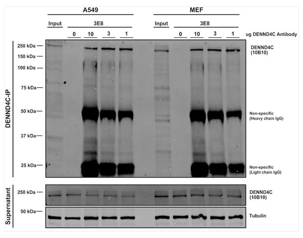 Immunoprecipitation analysis using Mouse Anti-DENND4C Monoclonal Antibody, Clone 3E8 (STMA00216). Tissue: A549, MEF cells. Species: Human, Mouse. Primary Antibody: Mouse Anti-DENND4C Monoclonal Antibody (STMA00216). Three amounts of STMA00216 (10, 3, and 1 ug) were non-covalently coupled to 10uL of A/G sepharose beads for 1 hour at 4°C and next incubated with 250ug of A549 or MEF lysate for 2 hours at 4°C.