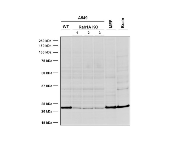 Western Blot analysis of Human, Mouse A549 WT and KO cells, MEF, mouse brain cells showing detection of RAB1A protein using Mouse Anti-RAB1A Monoclonal Antibody, Clone 4G10 (STMA00218). Lane 1: MW ladder. Lane 2: WT A549 cells. Lane 3-5: KO A549 clones. Lane 6: MEF cells. Lane 7: mouse brain cells. Load: 10 ug (A549, MEF); 20 ug (Mouse Brain). Primary Antibody: Mouse Anti-RAB1A Monoclonal Antibody (STMA00218) at 1:1000.