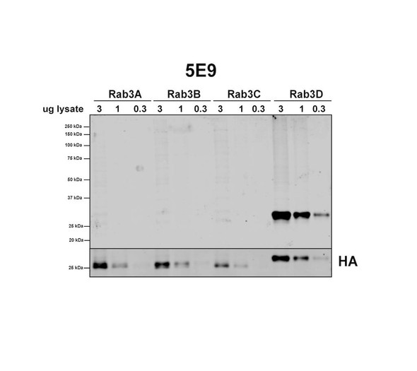 Western Blot analysis of Human HEK293 cells overexpressing RAB3A, RAB3B, RAB3C, and RAB3D showing detection of RAB3D protein using Mouse Anti-RAB3D Monoclonal Antibody, Clone 5E9 (STMA00219). Lane 1: MW ladder. Lanes 2-4: HEK293 cells overexpressing RAB3A. Lanes 5-7: HEK293 cells overexpressing RAB3B. Lanes 8-10: HEK293 cells overexpressing RAB3C. Lanes 11-13: HEK293 cells overexpressing RAB3D.