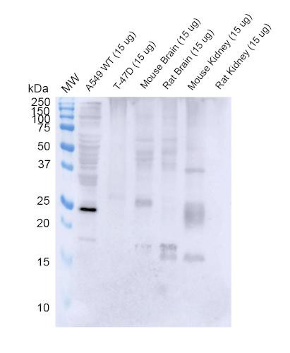 Western Blot analysis of Human, Mouse, Rat A549, T-47D cells, mouse and rat brain, kidney showing detection of RAB3D protein using Mouse Anti-RAB3D Monoclonal Antibody, Clone 5E9 (STMA00219). Lane 1: MW ladder. Lane 2: WT A549 cells. Lane 3: T-47D cells. Lane 4: mouse brain. Lane 5: rat brain. Lane 6: mouse kidney. Lane 7: rat kidney. Load: 15 ug. Block: 5% Skim Milk Powder in TBST.