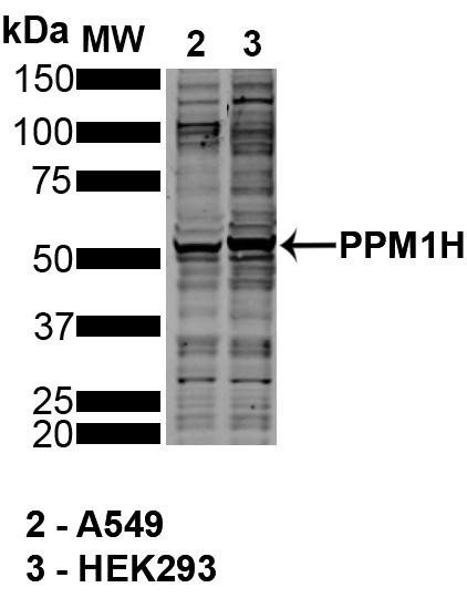 Western Blot analysis of Hu, Ms, Rt Kidney Cells (HEK293), Alveolar Basal Epithelial cells (A549) showing detection of ~55 PPM1H protein using Mouse Anti-PPM1H Monoclonal Antibody, Clone 10D2 (STMA00221). Lane 1: MW Ladder. Lane 2: A549. Lane 3: HEK293. Load: 30 ug. Block: 5% Skim Milk in TBST, 1h, RT. Primary Antibody: Mouse Anti-PPM1H Monoclonal Antibody (STMA00221) at 1:1000 for Overnight, 4C.