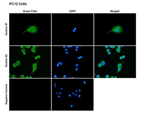 Immunocytochemistry/Immunofluorescence analysis with Rabbit Anti-Rat SAP97 Monoclonal Antibody, Clone G28 (STMA00235). Tissue: Pheochromocytoma cells (PC-12). Species: Rat. Fixation: 4% PFA for 10 min at RT. Permeabilization: 0.15% TritonX for 15 min at RT. Blocking: 10% goat serum for 40 min at RT. Primary Antibody: Rabbit Anti-Rat SAP97 Recombinant Monoclonal [G28] (STMA00235) at 1:100 for 1 hour at RT.