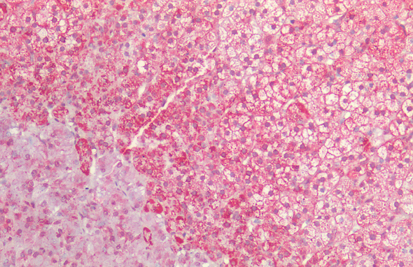 Immunohistochemistry analysis using Rabbit Anti-HSP60 Polyclonal Antibody (STPA00004). Tissue: Adrenal. Species: Human. Fixation: Formalin fixed paraffin-embedded. Primary Antibody: Rabbit Anti-HSP60 Polyclonal Antibody (STPA00004).