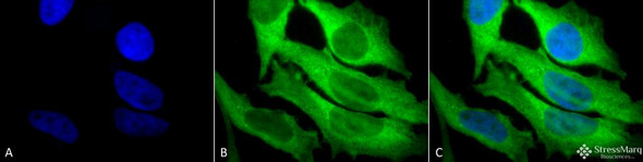 Immunocytochemistry/Immunofluorescence analysis using Rabbit Anti-Hsp27 Polyclonal Antibody (STPA00005). Tissue: Heat Shocked Cervical cancer cell line (HeLa). Species: Human. Fixation: 2% Formaldehyde for 20 min at RT. Primary Antibody: Rabbit Anti-Hsp27 Polyclonal Antibody (STPA00005) at 1:250 for 12 hours at 4°C. Secondary Antibody: FITC Goat Anti-Rabbit (green) at 1:200 for 2 hours at RT.