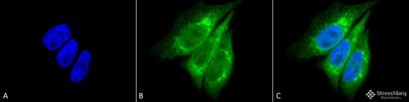 Immunocytochemistry/Immunofluorescence analysis using Rabbit Anti-KDEL Polyclonal Antibody (STPA00008). Tissue: Heat Shocked Cervical cancer cell line (HeLa). Species: Human. Fixation: 2% Formaldehyde for 20 min at RT. Primary Antibody: Rabbit Anti-KDEL Polyclonal Antibody (STPA00008) at 1:100 for 12 hours at 4°C. Secondary Antibody: FITC Goat Anti-Rabbit (green) at 1:200 for 2 hours at RT.