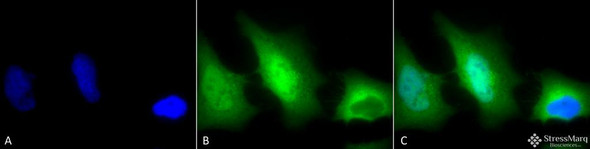 Immunocytochemistry/Immunofluorescence analysis using Rabbit Anti-SOD1 (Cu/Zn) Polyclonal Antibody (STPA00011). Tissue: Cervical cancer cell line (HeLa). Species: Human. Fixation: 2% Formaldehyde for 20 min at RT. Primary Antibody: Rabbit Anti-SOD1 (Cu/Zn) Polyclonal Antibody (STPA00011) at 1:120 for 12 hours at 4°C. Secondary Antibody: FITC Goat Anti-Rabbit (green) at 1:200 for 2 hours at RT.