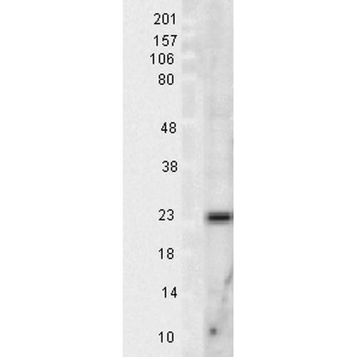 Western blot analysis of Rat Tissue lysates showing detection of SOD2 (Mn) protein using Rabbit Anti-SOD2 (Mn) Polyclonal Antibody (STPA00013). Load: 15 µgprotein. Block: 1.5% BSA for 30 minutes at RT. Primary Antibody: Rabbit Anti-SOD2 (Mn) Polyclonal Antibody (STPA00013) at 1:1000 for 2 hours at RT. Secondary Antibody: Donkey Anti-Rabbit IgG: HRP for 1 hour at RT.