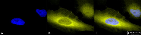 Immunocytochemistry/Immunofluorescence analysis using Rabbit Anti-Ubiquitin Polyclonal Antibody (STPA00015). Tissue: Heat Shocked Cervical cancer cell line (HeLa). Species: Human. Fixation: 2% Formaldehyde for 20 min at RT. Primary Antibody: Rabbit Anti-Ubiquitin Polyclonal Antibody (STPA00015) at 1:100 for 12 hours at 4°C. Secondary Antibody: R-PE Goat Anti-Rabbit (yellow) at 1:200 for 2 hours at RT.