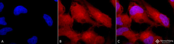 Immunocytochemistry/Immunofluorescence analysis using Rabbit Anti-Erk1/2 Polyclonal Antibody (STPA00016). Tissue: Cervical cancer cell line (HeLa). Species: Human. Fixation: 2% Formaldehyde for 20 min at RT. Primary Antibody: Rabbit Anti-Erk1/2 Polyclonal Antibody (STPA00016) at 1:100 for 12 hours at 4°C. Secondary Antibody: APC Goat Anti-Rabbit (red) at 1:200 for 2 hours at RT.