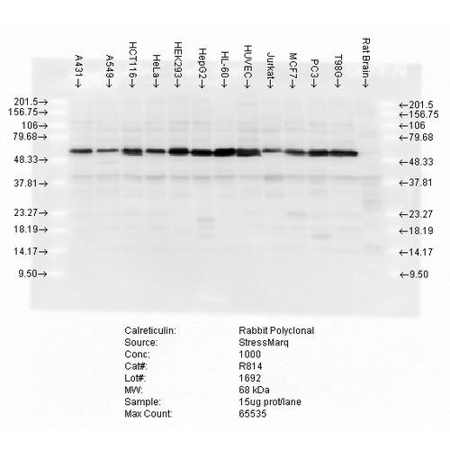 Western blot analysis of multiple cell lines lysates showing detection of Calreticulin protein using Rabbit Anti-Calreticulin Polyclonal Antibody (STPA00017). Load: 15 µgprotein. Block: 1.5% BSA for 30 minutes at RT. Primary Antibody: Rabbit Anti-Calreticulin Polyclonal Antibody (STPA00017) at 1:5000 for 2 hours at RT. Secondary Antibody: Donkey Anti-Rabbit IgG: HRP for 1 hour at RT.