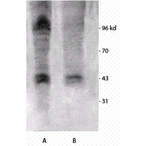 Western blot analysis of Mouse brain cell lysates showing detection of Phosphothreonine protein using Rabbit Anti-Phosphothreonine Polyclonal Antibody (STPA00022). Primary Antibody: Rabbit Anti-Phosphothreonine Polyclonal Antibody (STPA00022) at 1:1000. Left: Treated with Vanadium, Right: Non-treated.