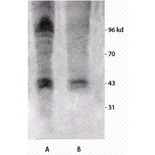 Western blot analysis of Mouse brain cell lysates showing detection of Phosphothreonine protein using Rabbit Anti-Phosphothreonine Polyclonal Antibody (STPA00022). Primary Antibody: Rabbit Anti-Phosphothreonine Polyclonal Antibody (STPA00022) at 1:1000. Left: Treated with Vanadium, Right: Non-treated.