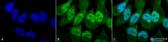 Immunocytochemistry/Immunofluorescence analysis using Rabbit Anti-Phosphothreonine Polyclonal Antibody (STPA00022). Tissue: Cervical cancer cell line (HeLa). Species: Human. Fixation: 2% Formaldehyde for 20 min at RT. Primary Antibody: Rabbit Anti-Phosphothreonine Polyclonal Antibody (STPA00022) at 1:60 for 12 hours at 4°C. Secondary Antibody: FITC Goat Anti-Rabbit (green) at 1:200 for 2 hours at RT.