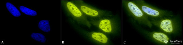 Immunocytochemistry/Immunofluorescence analysis using Rabbit Anti-Acetylated Lysine Polyclonal Antibody (STPA00023). Tissue: Heat Shocked Cervical cancer cell line (HeLa). Species: Human. Fixation: 2% Formaldehyde for 20 min at RT. Primary Antibody: Rabbit Anti-Acetylated Lysine Polyclonal Antibody (STPA00023) at 1:100 for 12 hours at 4°C. Secondary Antibody: R-PE Goat Anti-Rabbit (yellow) at 1:200 for 2 hours at RT.