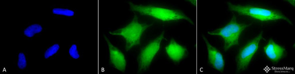 Immunocytochemistry/Immunofluorescence analysis using Rabbit Anti-Rab5 Polyclonal Antibody (STPA00025). Tissue: Cervical cancer cell line (HeLa). Species: Human. Fixation: 2% Formaldehyde for 20 min at RT. Primary Antibody: Rabbit Anti-Rab5 Polyclonal Antibody (STPA00025) at 1:80 for 12 hours at 4°C. Secondary Antibody: R-PE Goat Anti-Rabbit (yellow) at 1:200 for 2 hours at RT.