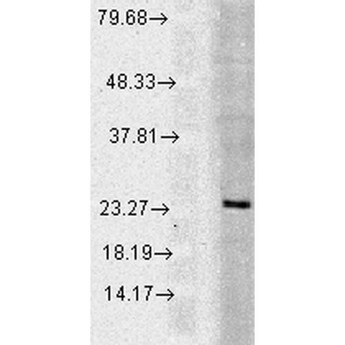 Western blot analysis of Human Cell line lysates showing detection of Rab5 protein using Rabbit Anti-Rab5 Polyclonal Antibody (STPA00025). Load: 15 µgprotein. Block: 1.5% BSA for 30 minutes at RT. Primary Antibody: Rabbit Anti-Rab5 Polyclonal Antibody (STPA00025) at 1:1000 for 2 hours at RT. Secondary Antibody: Donkey Anti-Rabbit IgG: HRP for 1 hour at RT.