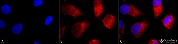 Immunocytochemistry/Immunofluorescence analysis using Rabbit Anti-TNF-R1 Polyclonal Antibody (STPA00026). Tissue: Cervical cancer cell line (HeLa). Species: Human. Fixation: 2% Formaldehyde for 20 min at RT. Primary Antibody: Rabbit Anti-TNF-R1 Polyclonal Antibody (STPA00026) at 1:100 for 12 hours at 4°C. Secondary Antibody: APC Goat Anti-Rabbit (red) at 1:200 for 2 hours at RT.