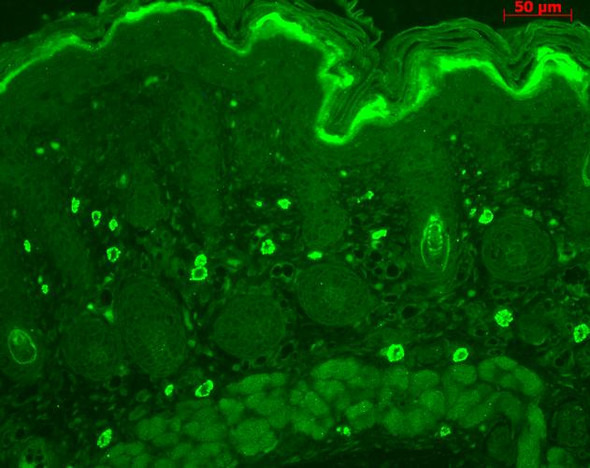 Immunohistochemistry analysis using Rabbit Anti-TNF-R1 Polyclonal Antibody (STPA00026). Tissue: backskin. Species: Mouse. Fixation: Bouin's Fixative Solution. Primary Antibody: Rabbit Anti-TNF-R1 Polyclonal Antibody (STPA00026) at 1:100 for 1 hour at RT. Secondary Antibody: FITC Goat Anti-Rabbit (green) at 1:50 for 1 hour at RT. Localization: dermis.