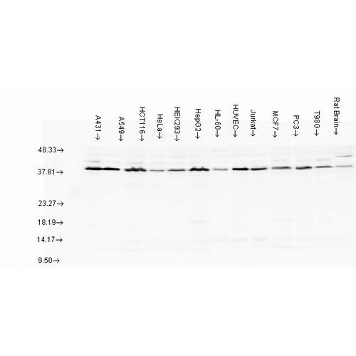 Western blot analysis of multiple Cell line lysates showing detection of AHA1 protein using Rabbit Anti-AHA1 Polyclonal Antibody (STPA00032). Load: 15 µgprotein. Block: 1.5% BSA for 30 minutes at RT. Primary Antibody: Rabbit Anti-AHA1 Polyclonal Antibody (STPA00032) at 1:1000 for 2 hours at RT. Secondary Antibody: Donkey Anti-Rabbit IgG: HRP for 1 hour at RT.
