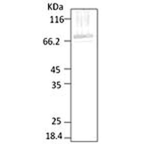 Western blot analysis of Parasite Lysates showing detection of HSP70 protein using Rabbit Anti-HSP70 Polyclonal Antibody (STPA00034). Primary Antibody: Rabbit Anti-HSP70 Polyclonal Antibody (STPA00034) at 1:2000.