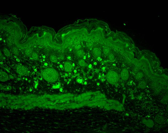 Immunohistochemistry analysis using Rabbit Anti-HSP110 Polyclonal Antibody (STPA00037). Tissue: backskin. Species: Mouse. Fixation: Bouin's Fixative Solution. Primary Antibody: Rabbit Anti-HSP110 Polyclonal Antibody (STPA00037) at 1:100 for 1 hour at RT. Secondary Antibody: FITC Goat Anti-Rabbit (green) at 1:50 for 1 hour at RT. Localization: Positive epidermal, dermal and muscle staining.