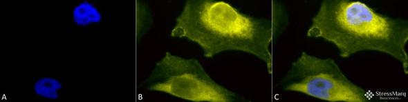 Immunocytochemistry/Immunofluorescence analysis using Rabbit Anti-SOD1 (UbetaB) Polyclonal Antibody (STPA00041). Tissue: Cervical cancer cell line (HeLa). Species: Human. Fixation: 2% Formaldehyde for 20 min at RT. Primary Antibody: Rabbit Anti-SOD1 (UbetaB） Polyclonal Antibody (STPA00041) at 1:110 for 12 hours at 4°C. Secondary Antibody: R-PE Goat Anti-Rabbit (yellow) at 1:200 for 2 hours at RT.
