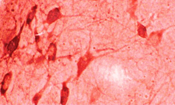 Immunohistochemistry analysis using Rabbit Anti-HO-1 Polyclonal Antibody (STPA00043). Tissue: Brain. Species: Rat. Primary Antibody: Rabbit Anti-HO-1 Polyclonal Antibody (STPA00043) at 1:1000.