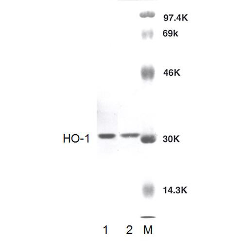 Western blot analysis of Rat Brain cell lysates showing detection of HO-1 protein using Rabbit Anti-HO-1 Polyclonal Antibody (STPA00043). Lane 1: Rat Brain lysate. Lane 2: Purified HO-1. Lane 3: Molecular Weight Markers. Load: 10 µg. Primary Antibody: Rabbit Anti-HO-1 Polyclonal Antibody (STPA00043) at 1:1000.