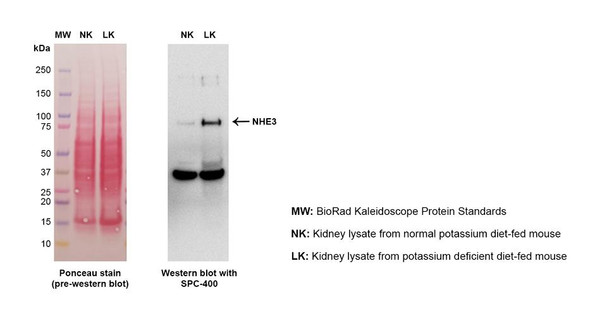 Western blot analysis with Rabbit Anti-Rat NHE3 Polyclonal Antibody (STPA00044) showing detection of NHE3 protein in mouse kidney lysates (NK = normal potassium, LK = potassium deficient) at the expected MW (~75 kDa), which increases under potassium deficient conditions – a known stimulus to increase NHE3 abundance. The band observed at 37 kDa was determined to be non-specific binding.