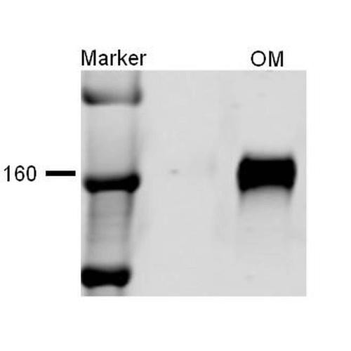 Western blot analysis of Rat kidney tissue lysates showing detection of NKCC2 protein using Rabbit Anti-NKCC2 Polyclonal Antibody (STPA00045). Primary Antibody: Rabbit Anti-NKCC2 Polyclonal Antibody (STPA00045) at 1:1000.