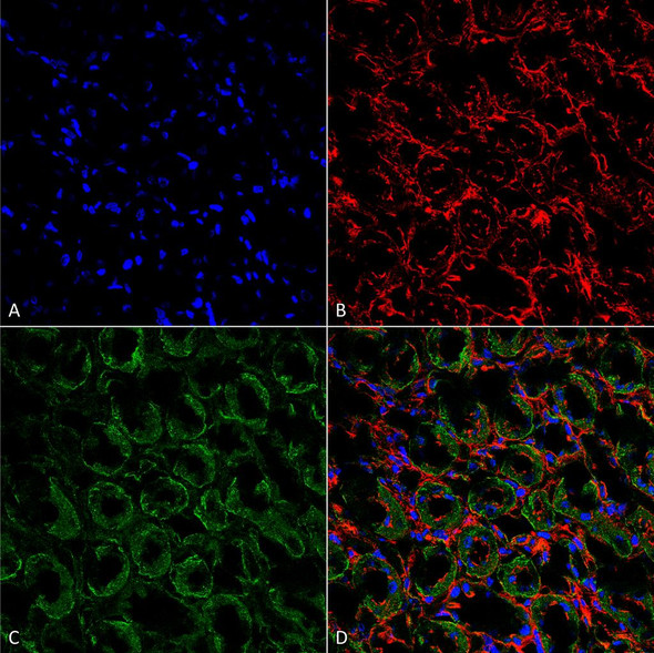 Immunohistochemistry analysis using Rabbit Anti-ENaC Polyclonal Antibody (STPA00047). Tissue: kidney tissue. Species: Rat. Fixation: Formalin Fixed Paraffin-Embedded. Primary Antibody: Rabbit Anti-ENaC Polyclonal Antibody (STPA00047) at 1:25 for 1 hour at RT. Secondary Antibody: Goat Anti-Rabbit IgG: Alexa Fluor 488. Counterstain: Actin-binding Phalloidin-Alexa Fluor 633; DAPI (blue) nuclear stain. Magnification: 63X.