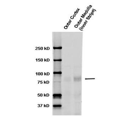 Western blot analysis of Rat kidney tissue lysates showing detection of ENaC protein using Rabbit Anti-ENaC Polyclonal Antibody (STPA00047). Primary Antibody: Rabbit Anti-ENaC Polyclonal Antibody (STPA00047) at 1:1000.