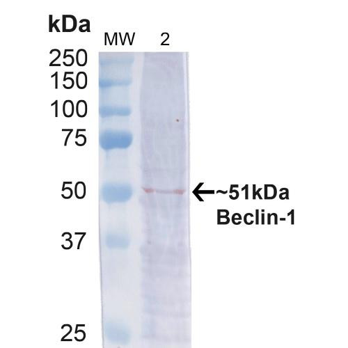 Western blot analysis of Human Cervical cancer cell line (HeLa) lysate showing detection of ~51kDa Beclin 1 protein using Rabbit Anti-Beclin 1 Polyclonal Antibody (STPA00057). Lane 1: MW Ladder. Lane 2: Human HeLa (20 µg). Load: 20 µg. Block: 5% milk + TBST for 1 hour at RT. Primary Antibody: Rabbit Anti-Beclin 1 Polyclonal Antibody (STPA00057) at 1:1000 for 1 hour at RT. Secondary Antibody: Goat Anti-Rabbit: HRP at 1:2000 for 1 hour at RT.