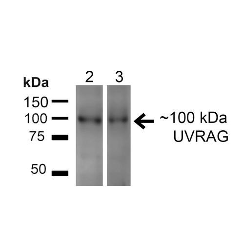 Western blot analysis of Human HeLa and HEK293T cell lysates showing detection of ~100kDa UVRAG protein using Rabbit Anti-UVRAG Polyclonal Antibody (STPA00059). Lane 1: MW Ladder. Lane 2: Human HeLa (20 µg). Lane 3: Human 293T (20 µg). Load: 20 µg. Block: 5% Skim Milk for 1 hour at RT. Primary Antibody: Rabbit Anti-UVRAG Polyclonal Antibody (STPA00059) at 1:200 for 1 hour at RT.