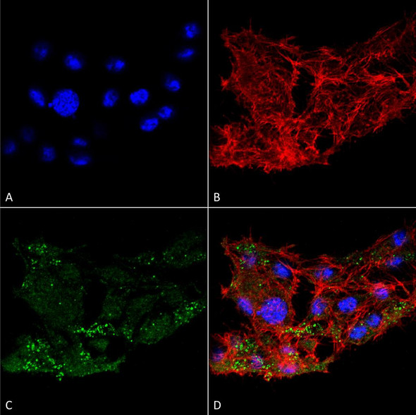 Immunocytochemistry/Immunofluorescence analysis using Rabbit Anti-ATG7 Polyclonal Antibody (STPA00060). Tissue: Colon carcinoma cell line (RKO). Species: Human. Fixation: 4% Formaldehyde for 15 min at RT. Primary Antibody: Rabbit Anti-ATG7 Polyclonal Antibody (STPA00060) at 1:100 for 60 min at RT. Secondary Antibody: Goat Anti-Rabbit ATTO 488 at 1:100 for 60 min at RT.